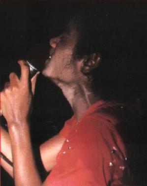 MichaelJacksonVvitiligo-1.jpg