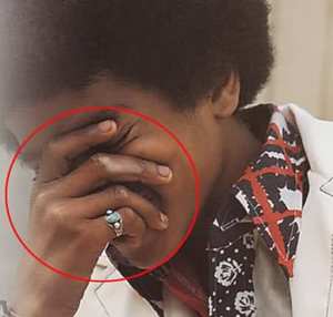 MichaelJacksonVvitiligo-2.jpg